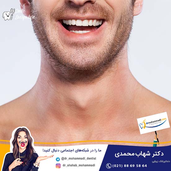 عوارض لمینت دندان، آیا لمینت سرامیکی ضرر دارد؟ - کلینیک دندانپزشکی دکتر شهاب محمدی